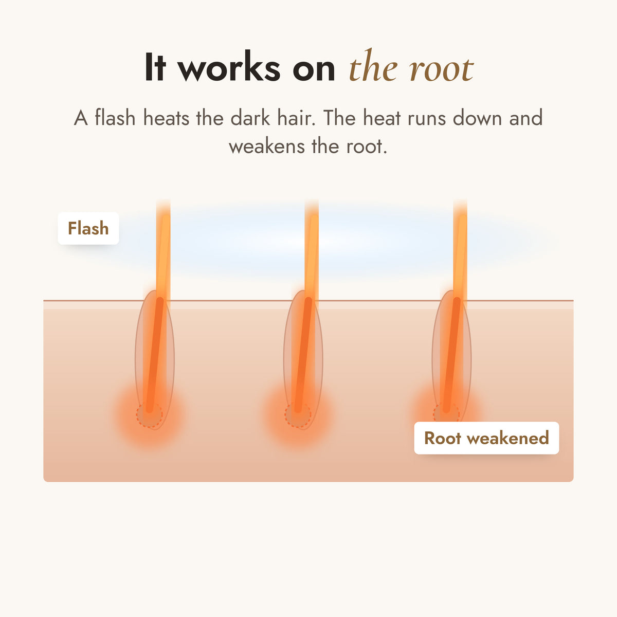 How it works: the root